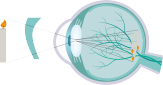 astigmatism lasik san diego